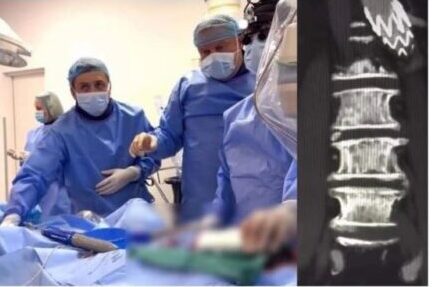 Вперше в Україні львівські медики імплантували пацієнту біфуркаційний протез